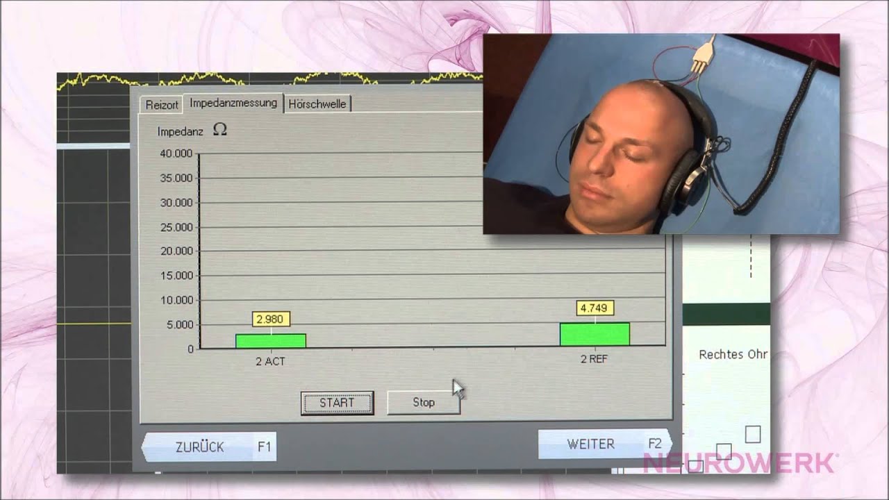 Evoked Potentials - AEP ABR