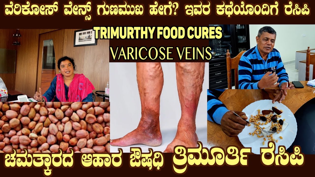 TRIMURTHY FOOD cured VERICOSE VEINS Live Testimony with Recipe by Dr S M Raju IAS (Rtd)