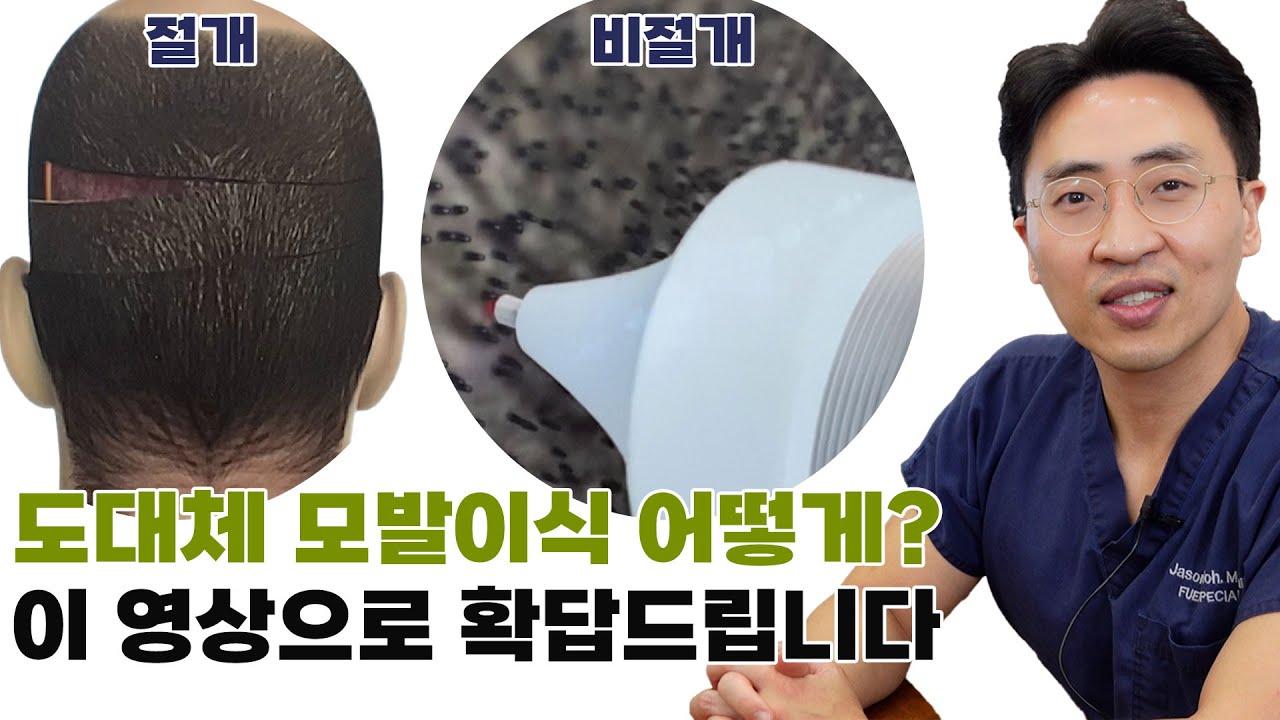 모발이식 절개, 비절개 고민한다면 해답 드립니다.