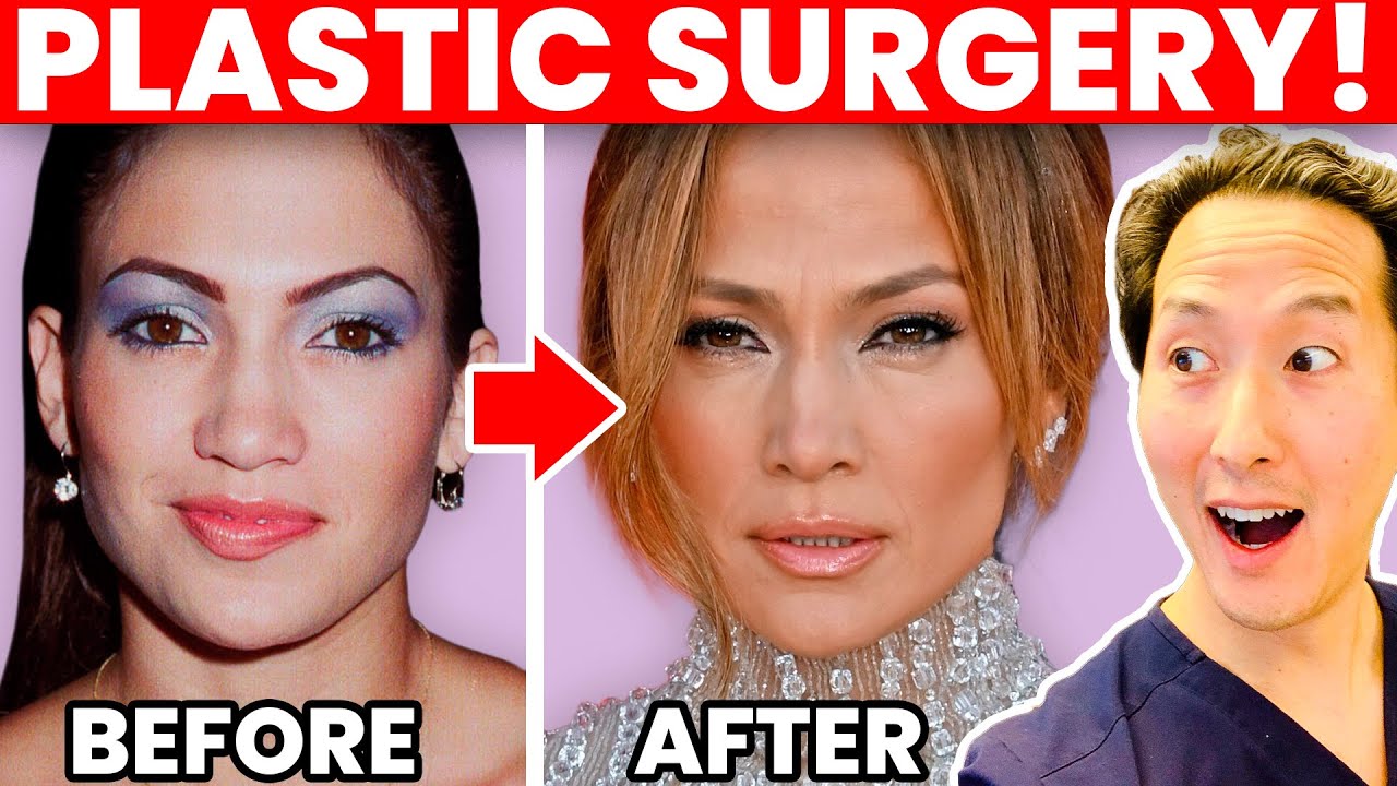 JENNIFER LOPEZ J. Lo Plastic Surgery Transformation - Cosmetic Surgeon Reacts!