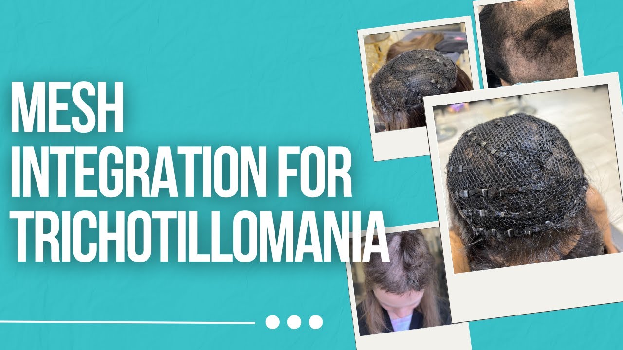 Why Mesh Integration is the PERFECT Solution for Trichotillomania
