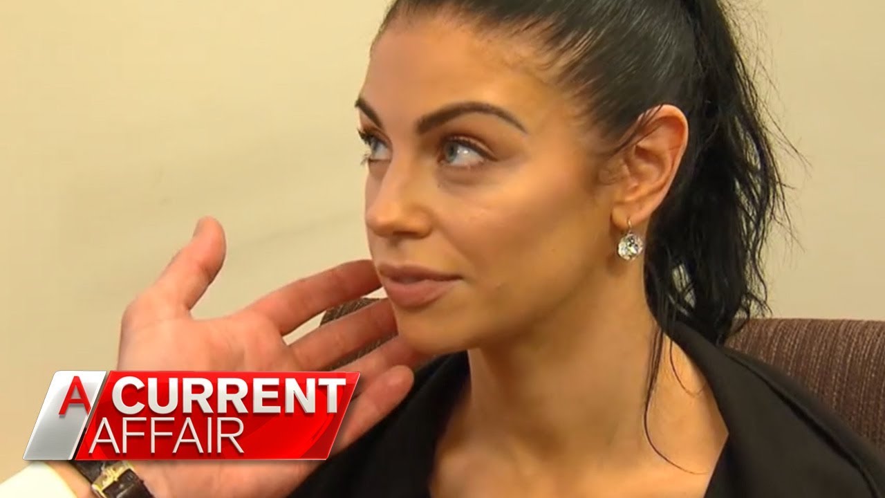 Cosmetic surgeon accused of disfiguring patients | A Current Affair Australia 2018