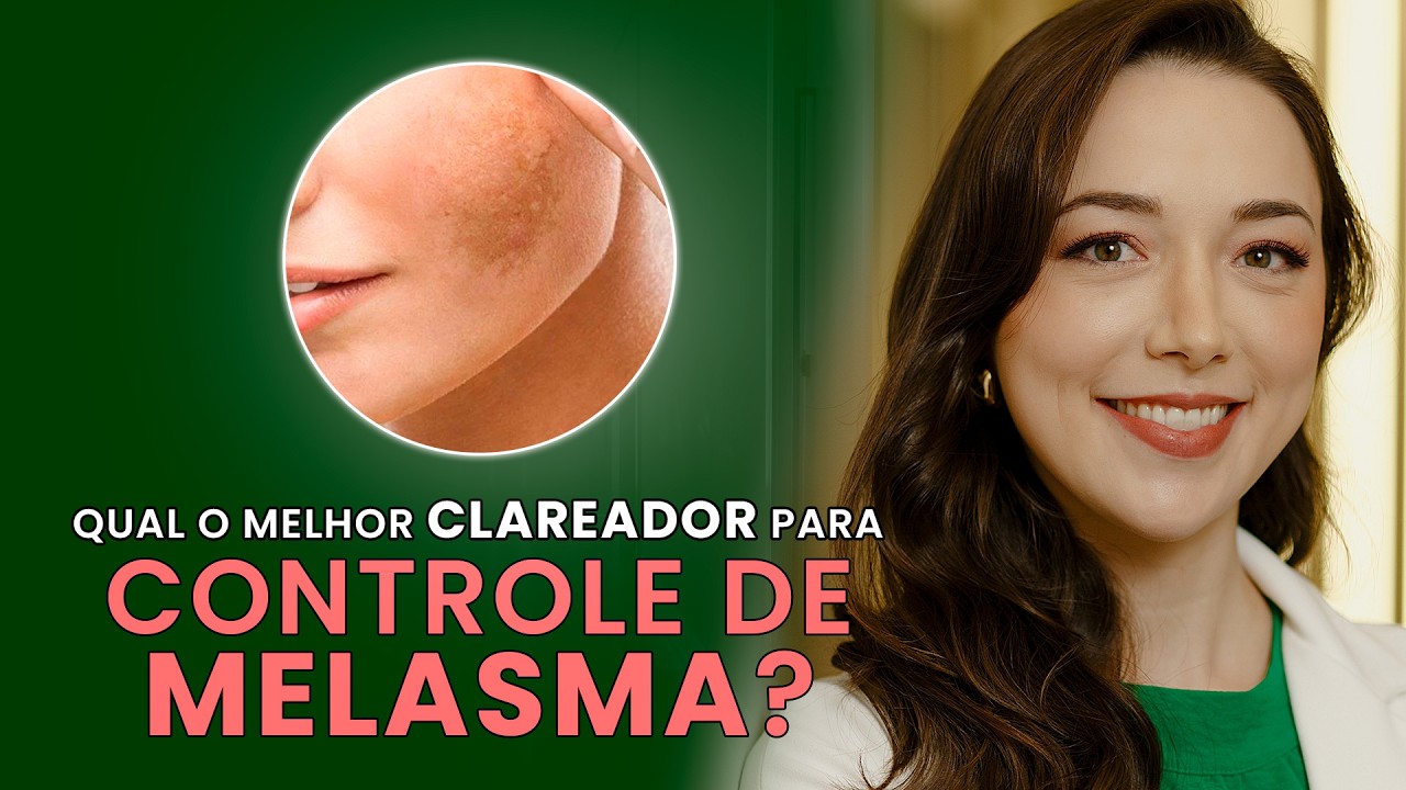 Melasma: O que é? Como tratar? E como usar clareadores na rotina de skincare?