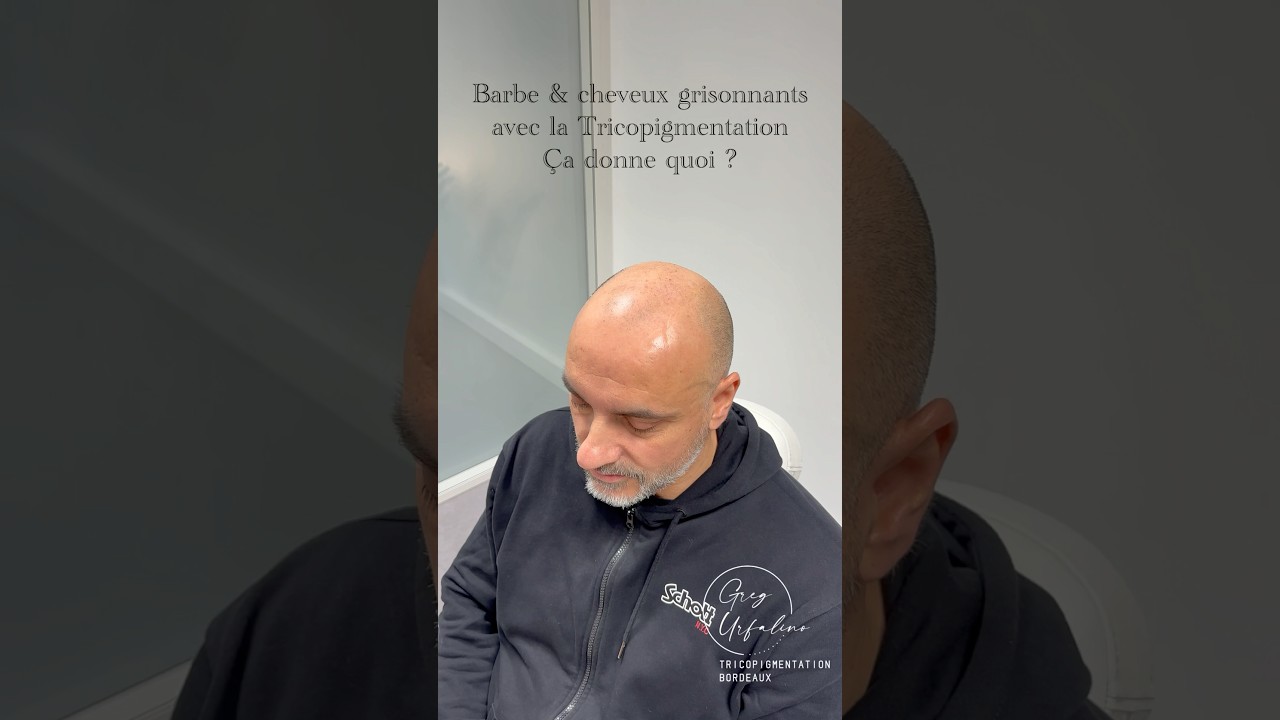Les cheveux grisonnants en Tricopigmentation effet ras&eacute; #tricopigmentation