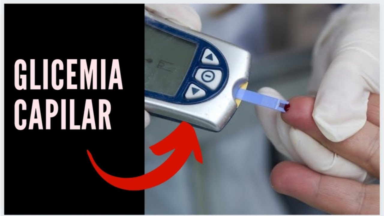 Controle da Glicemia Capilar - Descri&ccedil;&atilde;o da T&eacute;cnica passo a passo