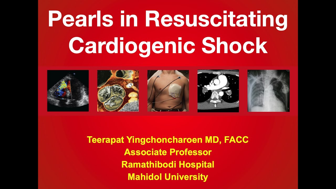 Cardiogenic shock part 1 : Overview, Definition, SCAI Stages, Etiology