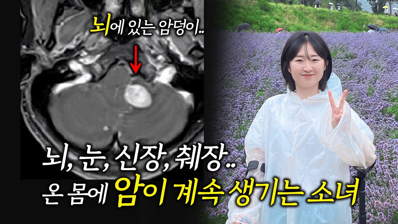 1년 약값만 2억 7천만원..그녀가 하반신 마비가 된 이유