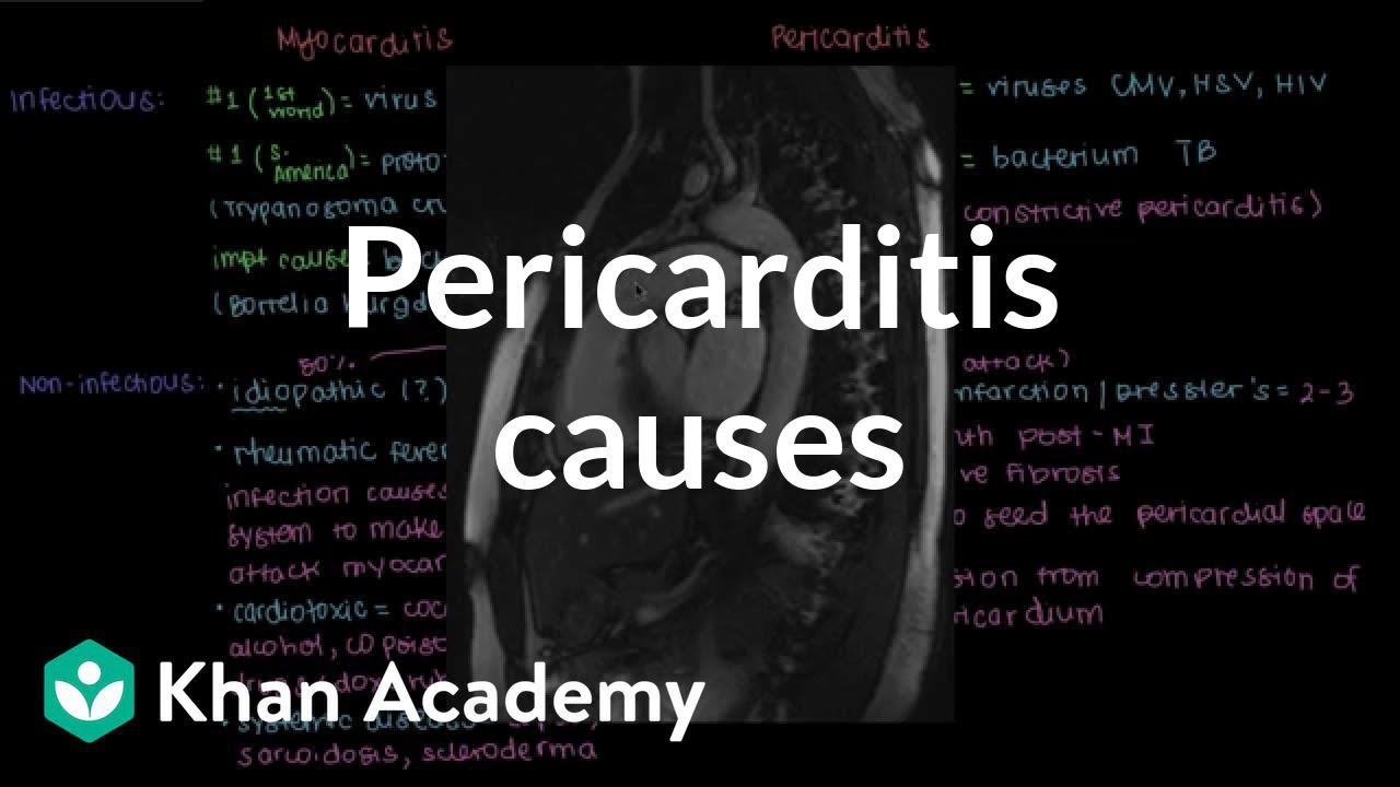 Causes of pericarditis | Circulatory System and Disease | NCLEX-RN | Khan Academy