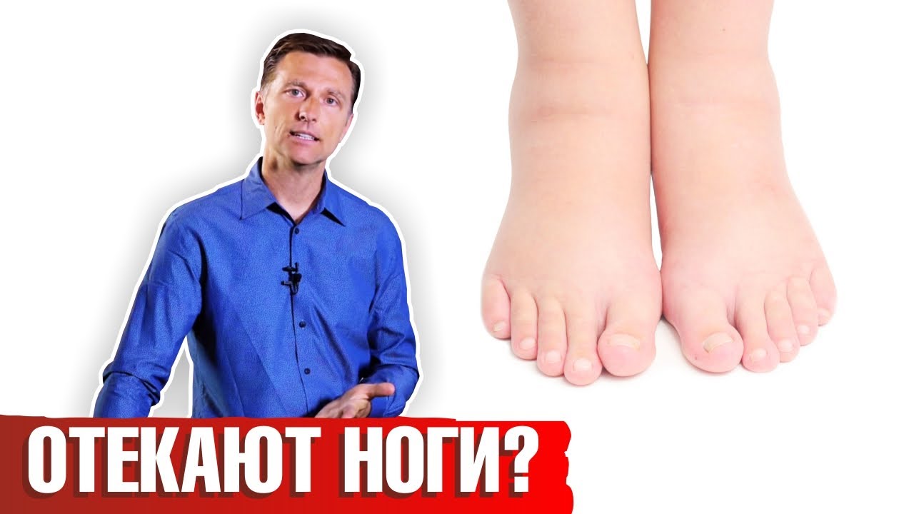 Отекают ноги: что делать? Как лечить отеки ног?