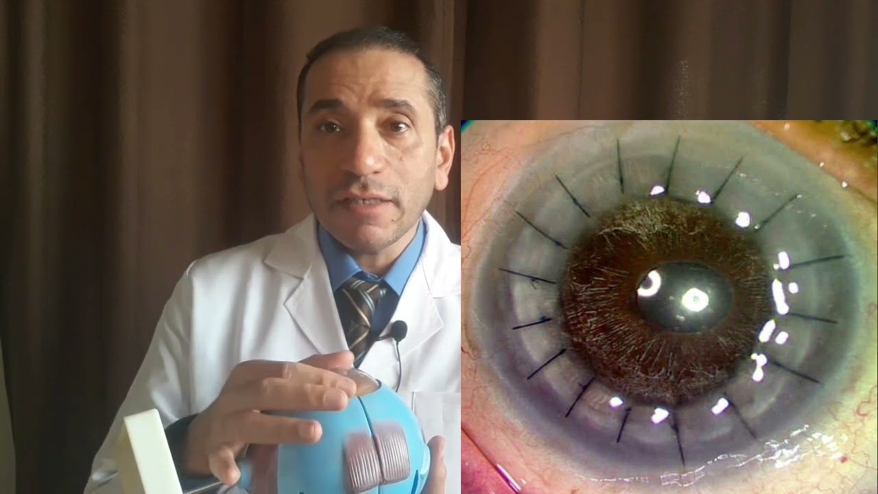 الفيمتوليزر Femtosecond laser
