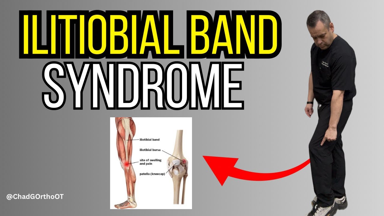 IT Band Syndrome Rehab Program (Exercises for Hip Stability, Pain Relief & Return to Function)