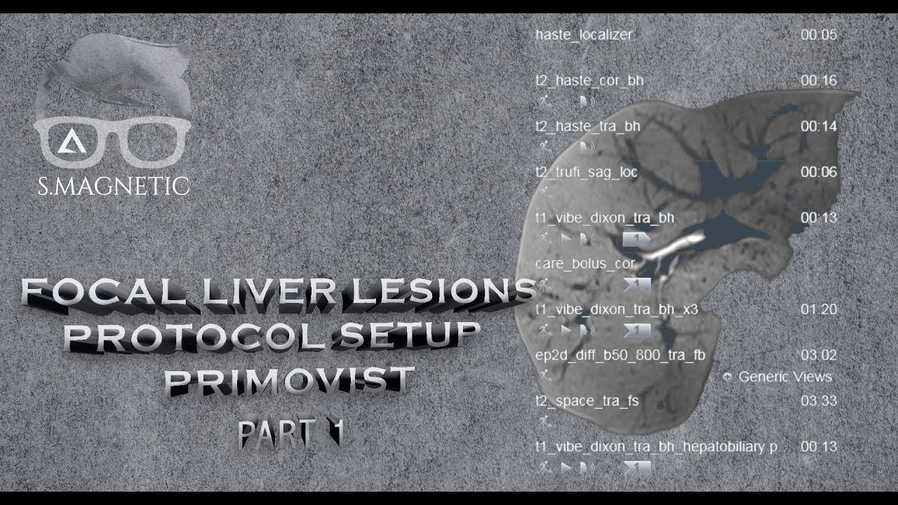 FOCAL LIVER LESIONS - PROTOCOL SETUP W/ PRIMOVIST PART 1