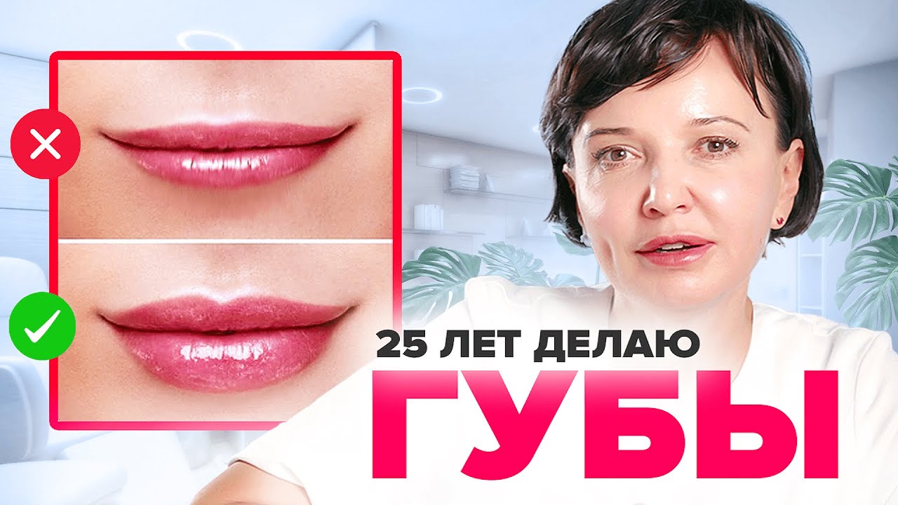 Увеличение губ филлерами гиалуроновой кислоты. Как увеличить губы без последствий | Ирина Рахова