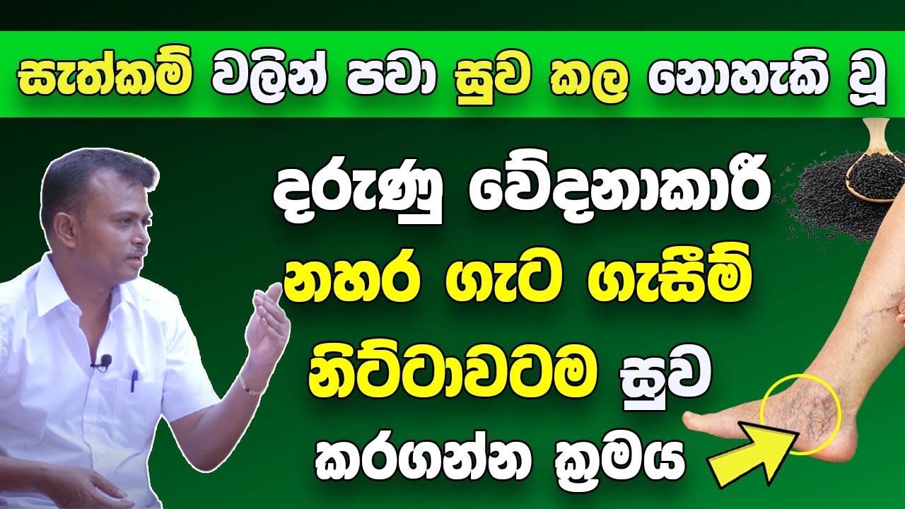 දරුණු සැත්කම් වලින් පවා සුව කල නොහැකි වූ නහර ගැට ගැසීමේ රෝගය | නිට්ටවටම සුව කරන විශ්මිත රහස | Arogya