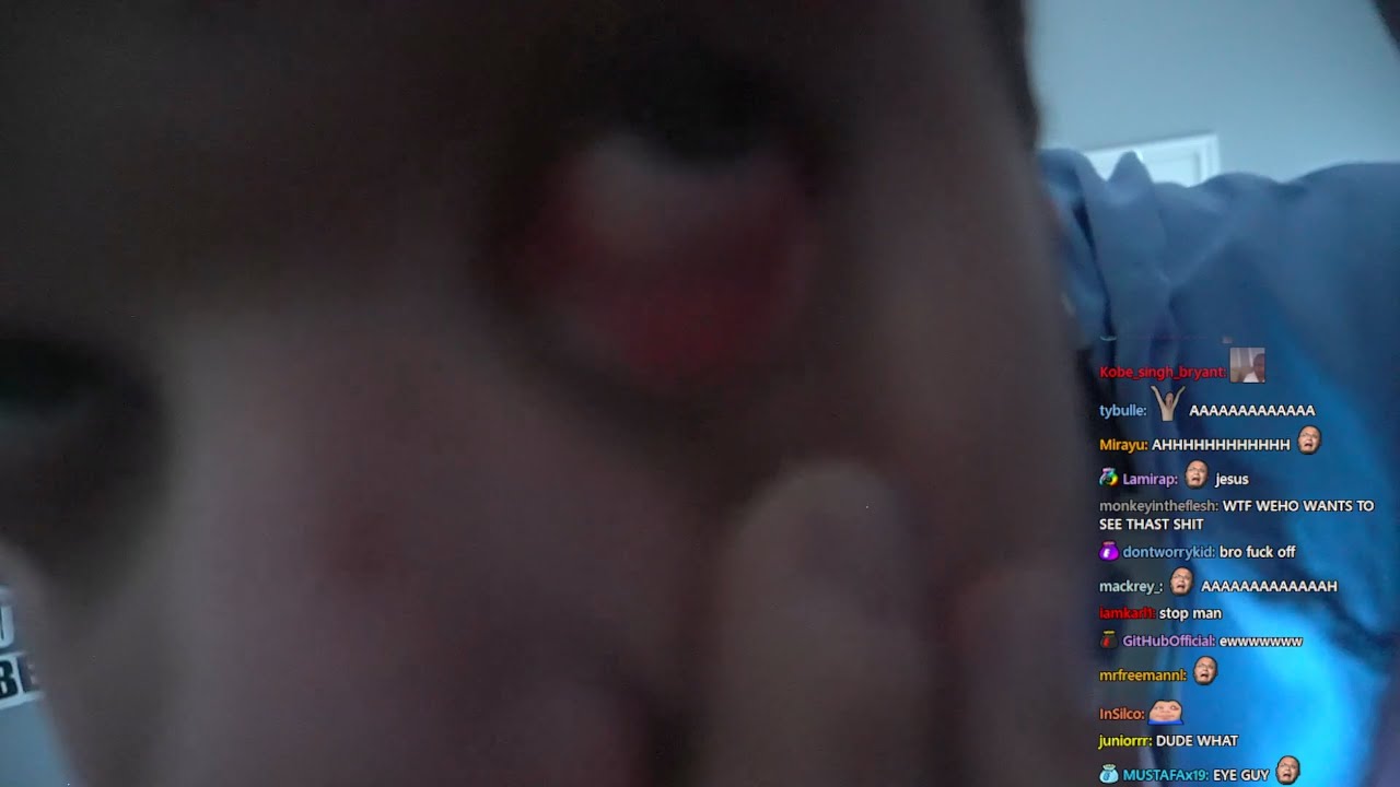 [1/2] 2024-01-12 'lost an eye today'