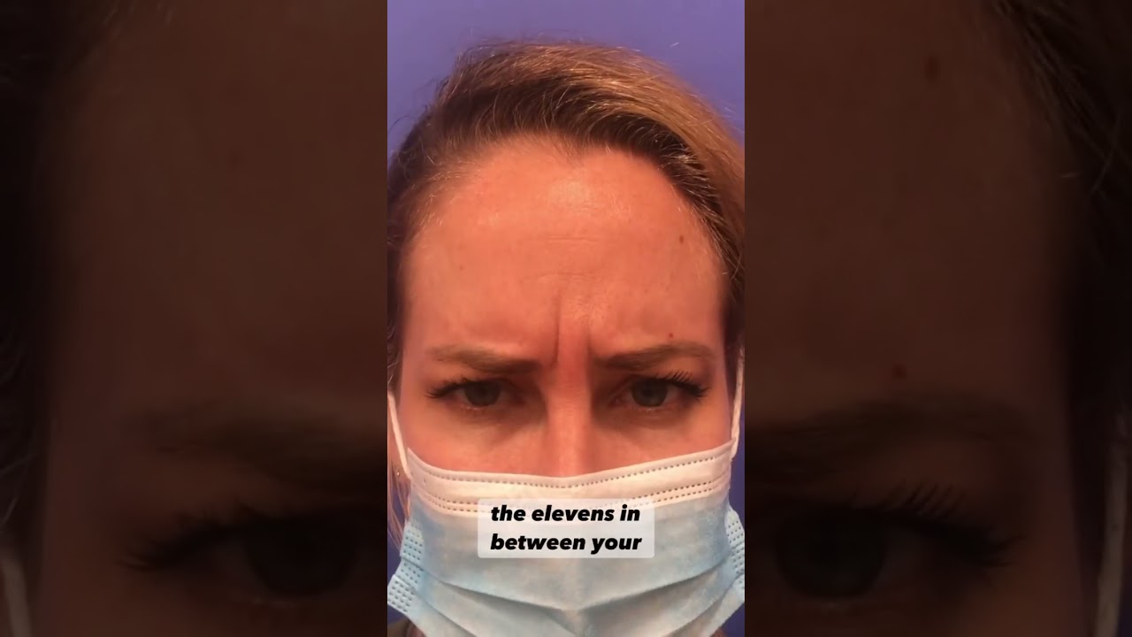 BOTOX VS XEOMIN Which is best for YOU?