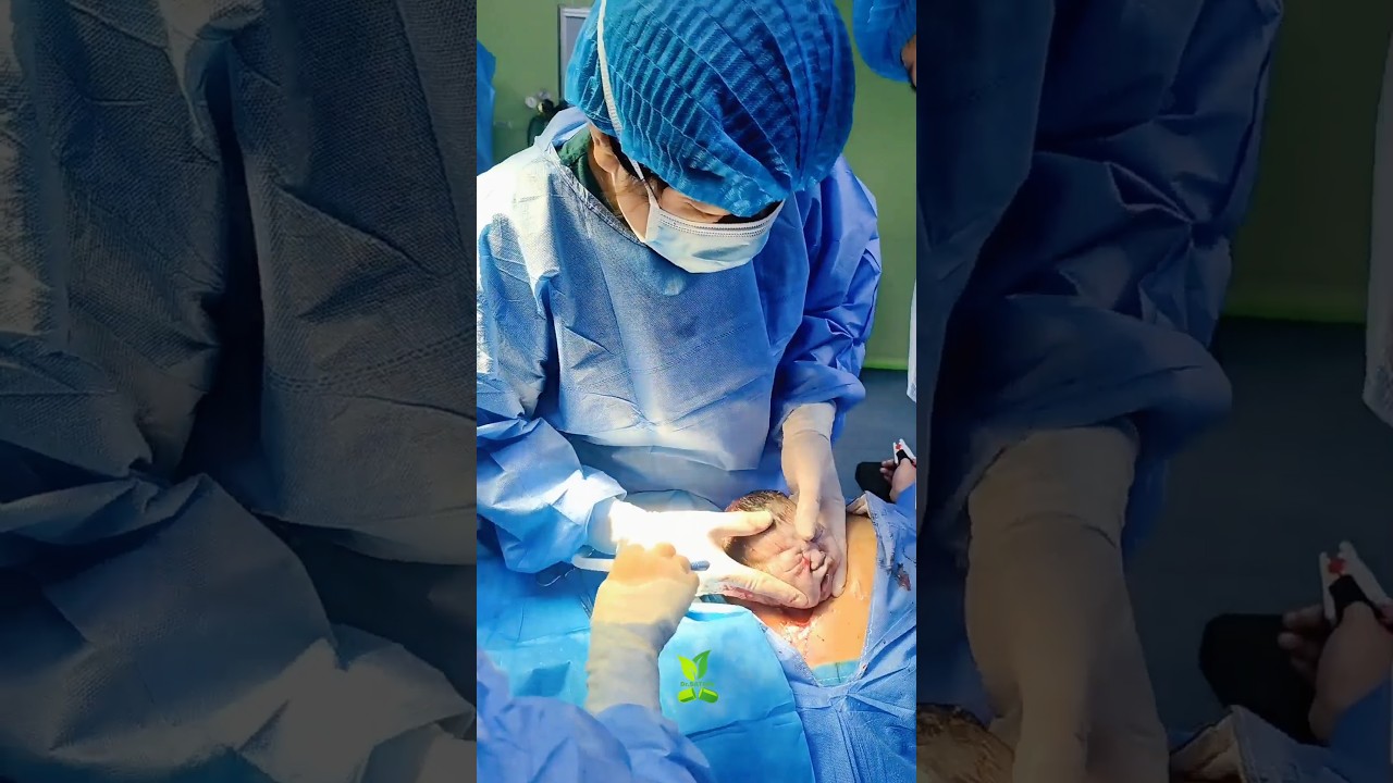 cesarean section Mother and child are safe 🙏 #shorts