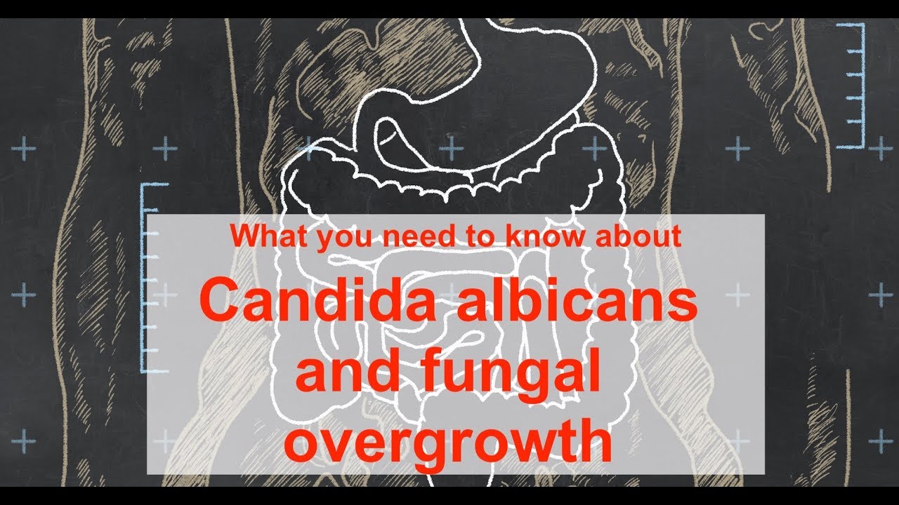 What you should know about Candida albicans and fungal overgrowth
