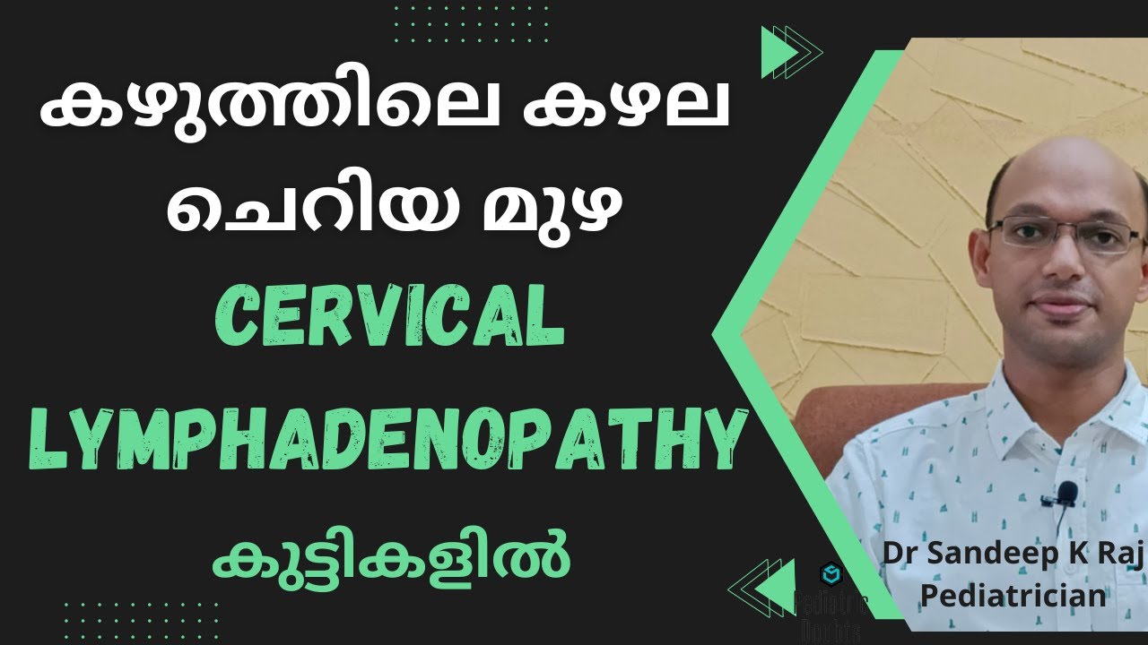 Cervical Lymphadenopathy | കുട്ടികളിലെ കഴല വീക്കം 