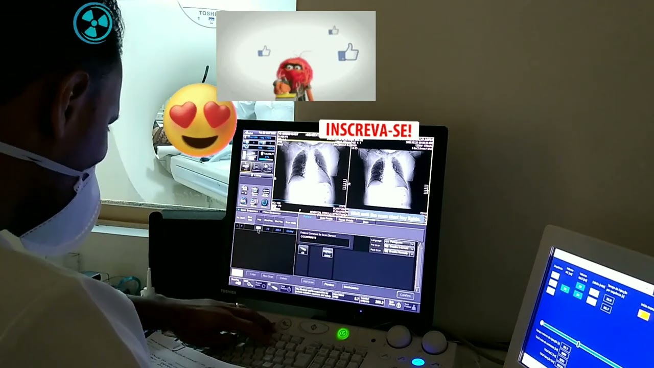 Tomografia de Tórax com contraste