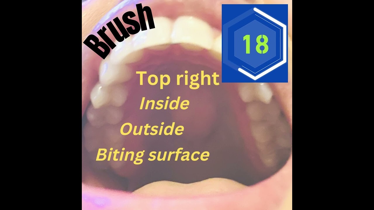 Toothbrushing timer