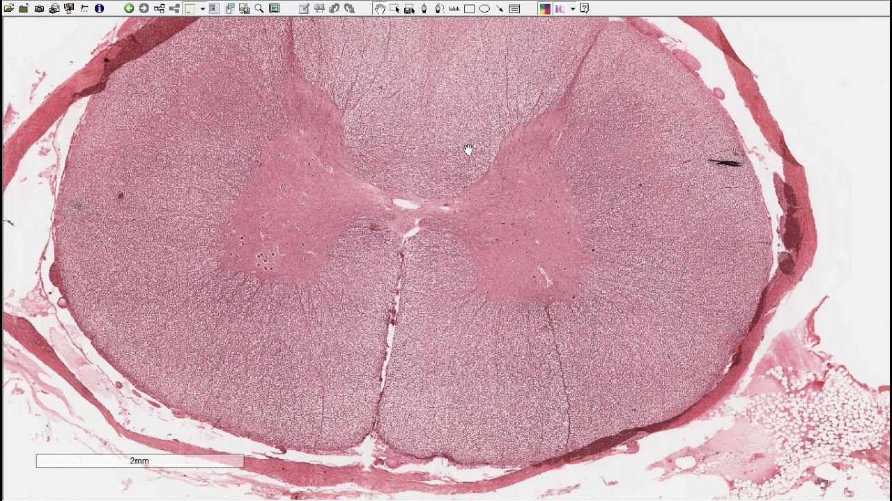 Histoloji - Medulla Spinalis & Spinal Ganglion