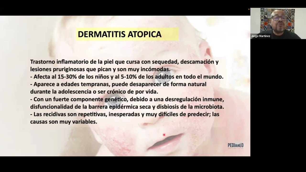 Microbiota y dermatitis Atopica
