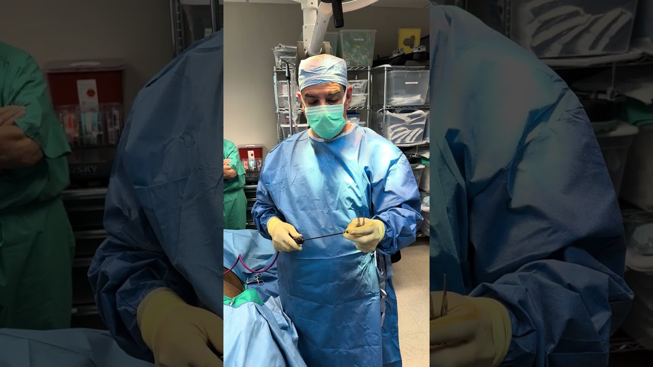 Skin Tightening after liposuction with Renuvion also known as Jplasma.