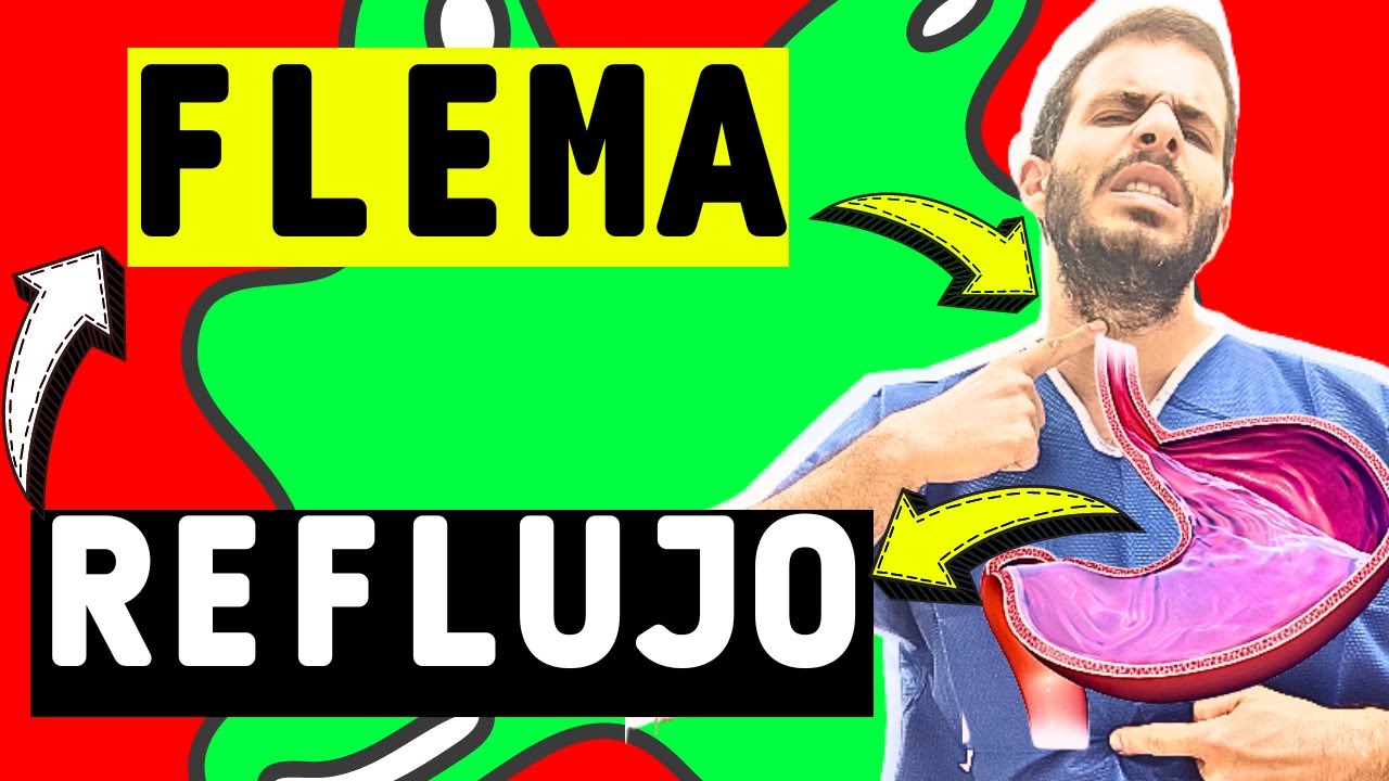 ✅ FLEMAS en la garganta, TOS y REFLUJO GÁSTRICO ¿Cómo se relacionan? ¿Existe una cura?