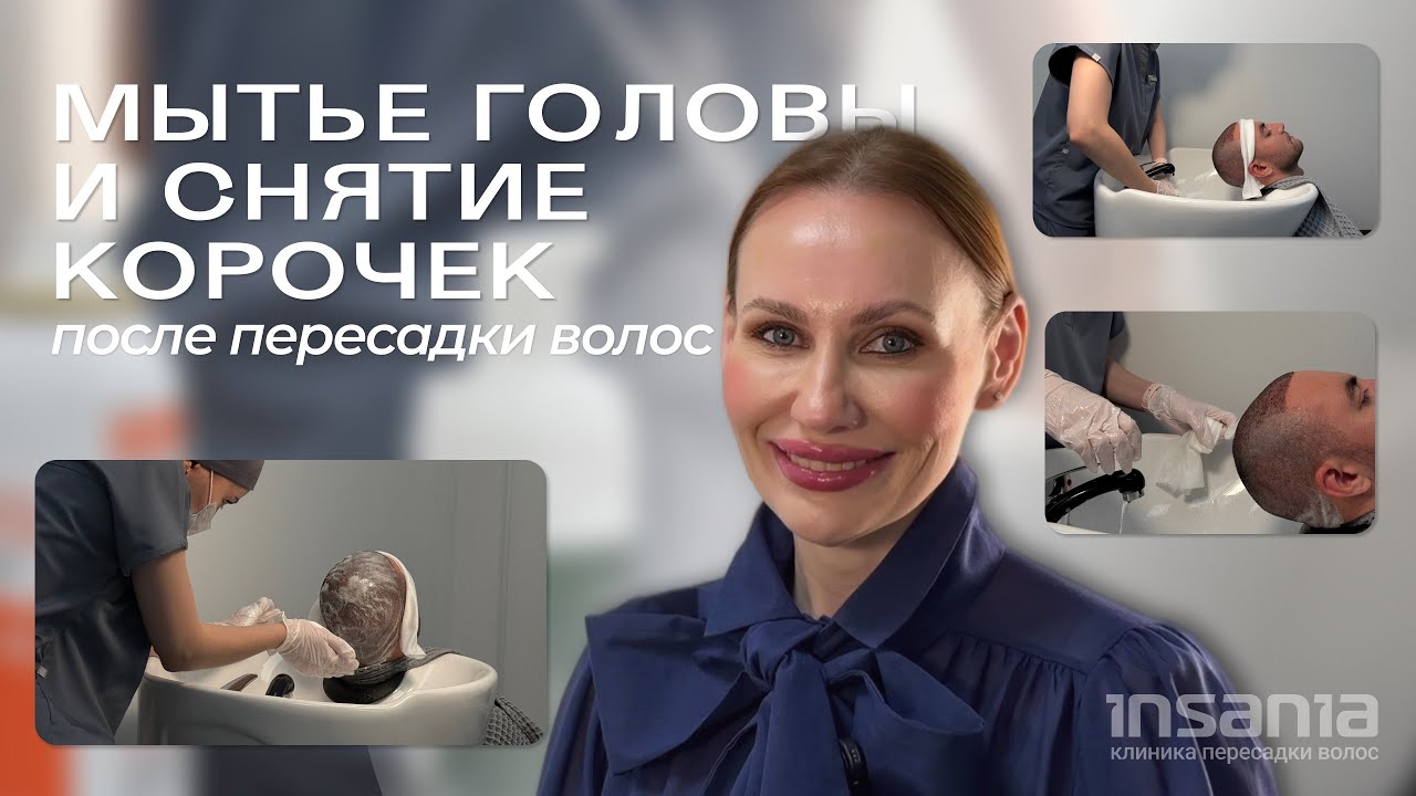 Мытье головы и снятие корочек после пересадки волос