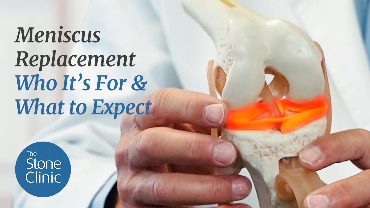Meniscus Transplant - Who's It For & What To Expect
