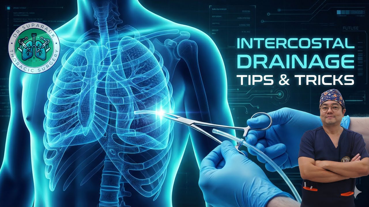 การใส่สายระบายทรวงอก (ICD ; intercostal drainage) 