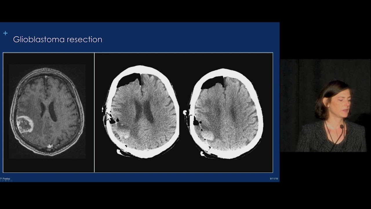 Emergent Postoperative Complications of the Brain and Spine | Free Radiology CME