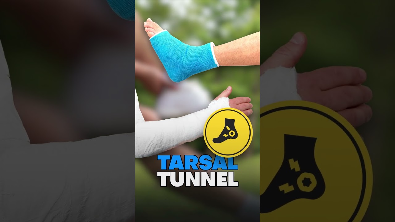 What Is A Repetitive Stress Injury? (AKA 
