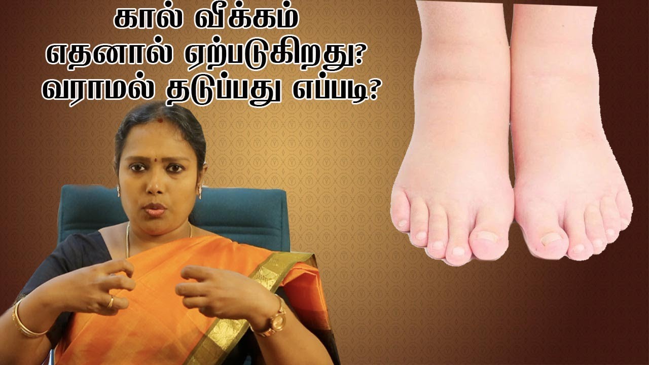 கால் வீக்கம் எதனால் ஏற்படுகிறது? வராமல் தடுப்பது எப்படி?