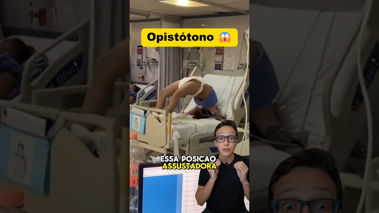 Sintoma de T&eacute;tano 😱#medicina #medico #enfermagem #enfermeiro #enfermeira #curiosidades Opist&oacute;tono