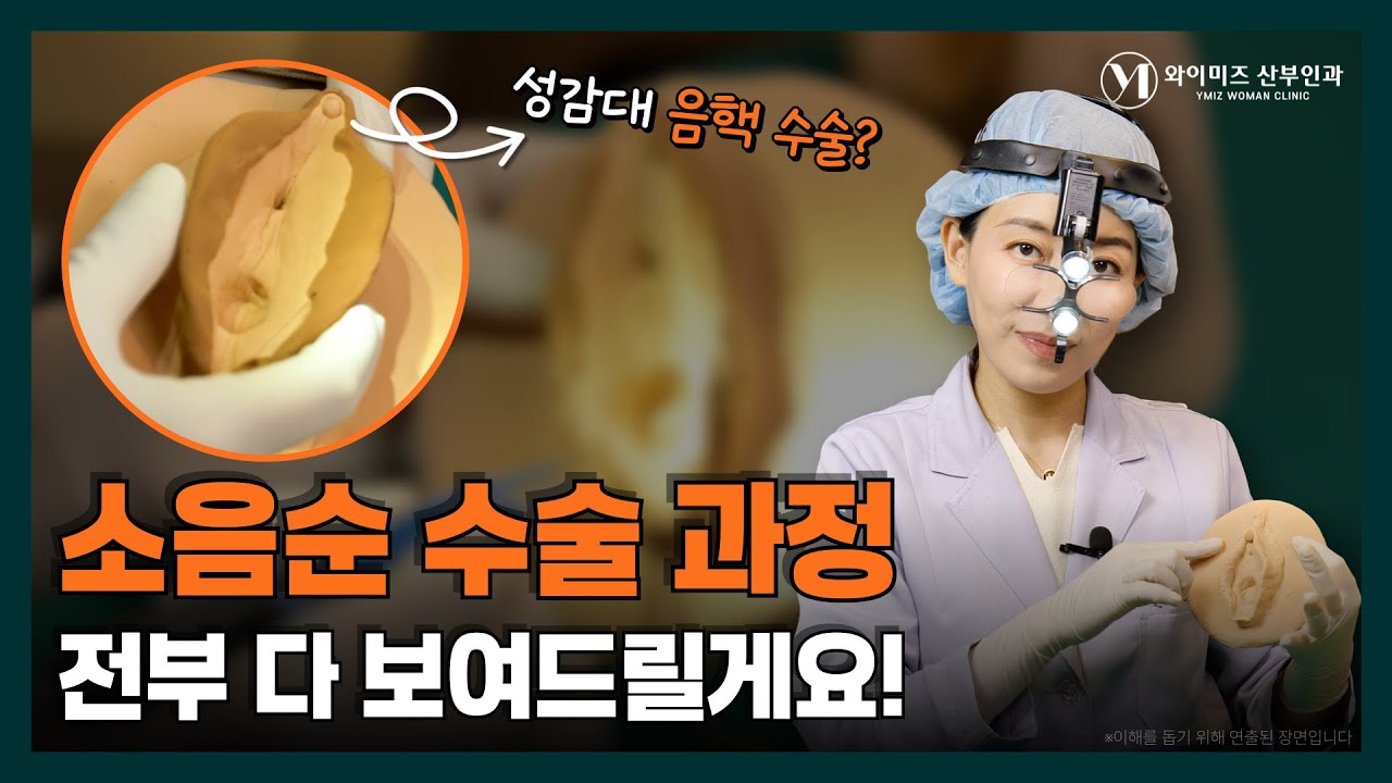 성감대 음핵? 소음순수술 과정 전부 다 보여드릴게요! (소음순성형 전 필수 시청 영상)