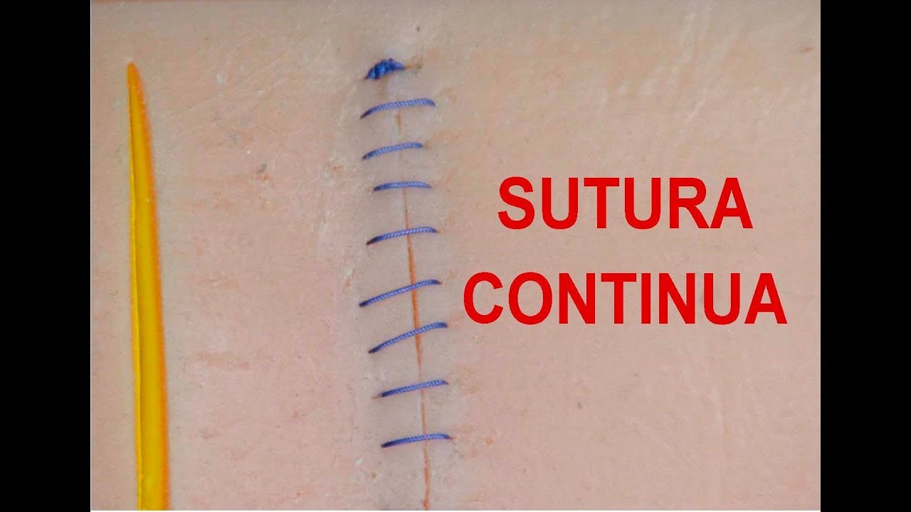 Suturas quirúrgicas. SUTURA  CONTINUA. Requiere entrenamiento y paciencia. El paciente lo agradecerá