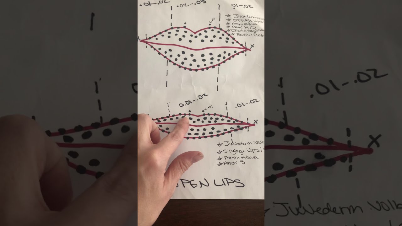 HYALURON PEN LIPS: Products & Placement