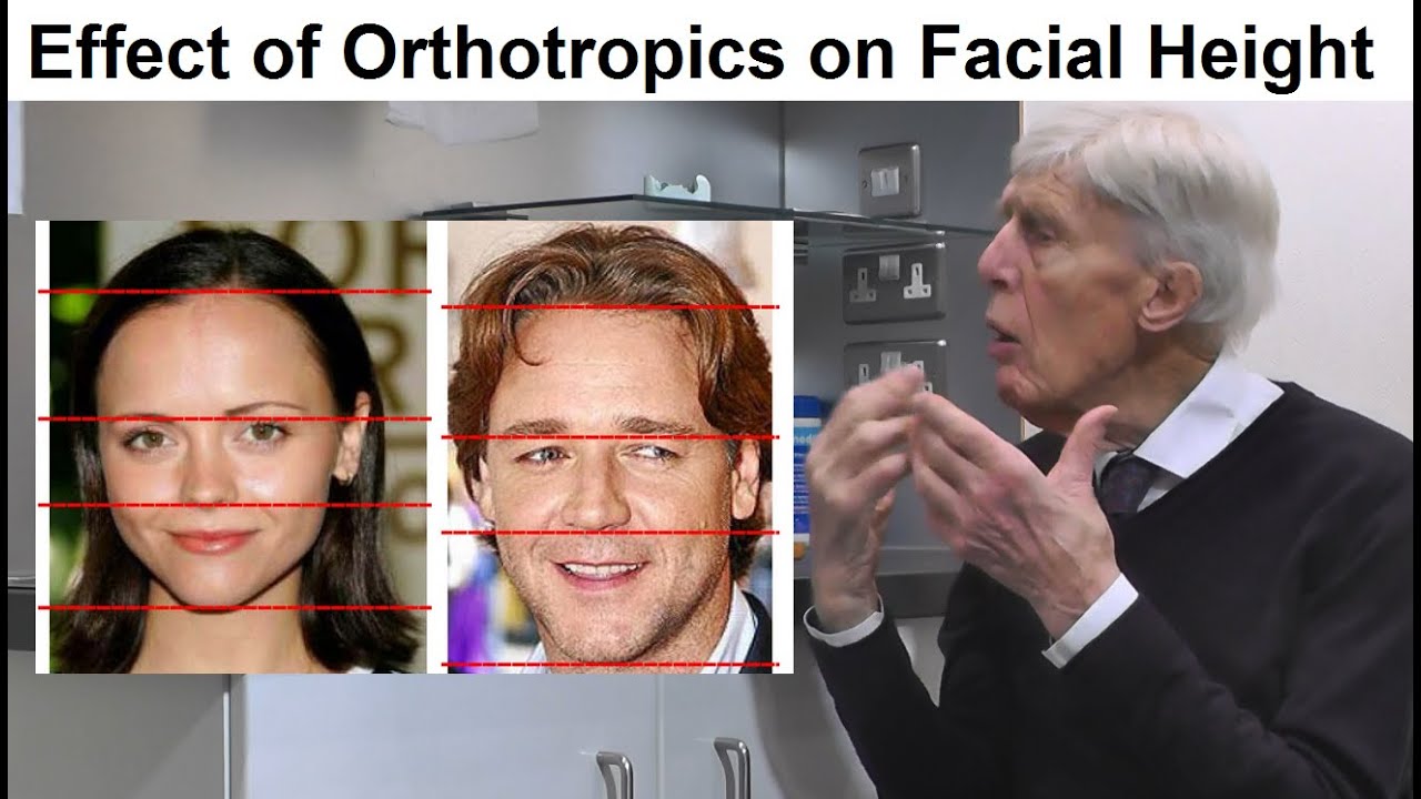 Is Orthotropics Treatment Able to Affect the Length of the Face by Prof John Mew