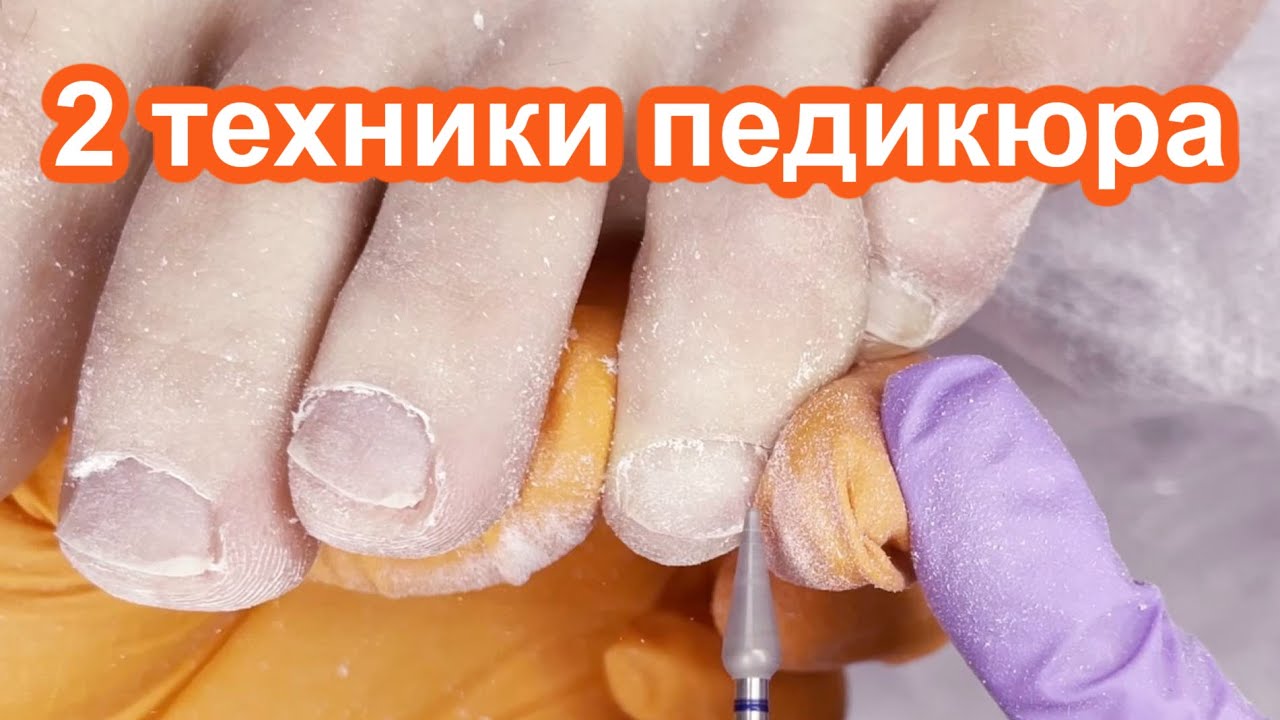Аппаратный Педикюр - 2 Техники с использованием Препаратов от ARAVIA | Обработка Натоптышей