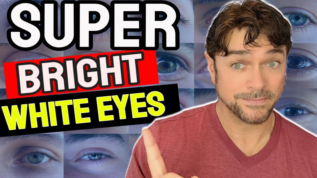 How To Get WHITER EYES | 6 Steps To Make Eyes Clear Bright & White | Chris Gibson