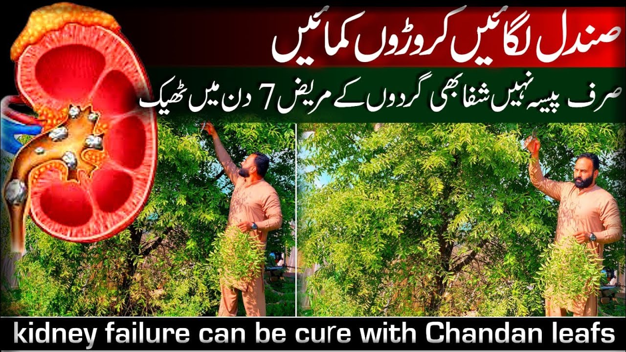 Sandal Chandan tree can make you billionaire | Sandal/Chandan Farming in Pakistan 🌳 💸 
