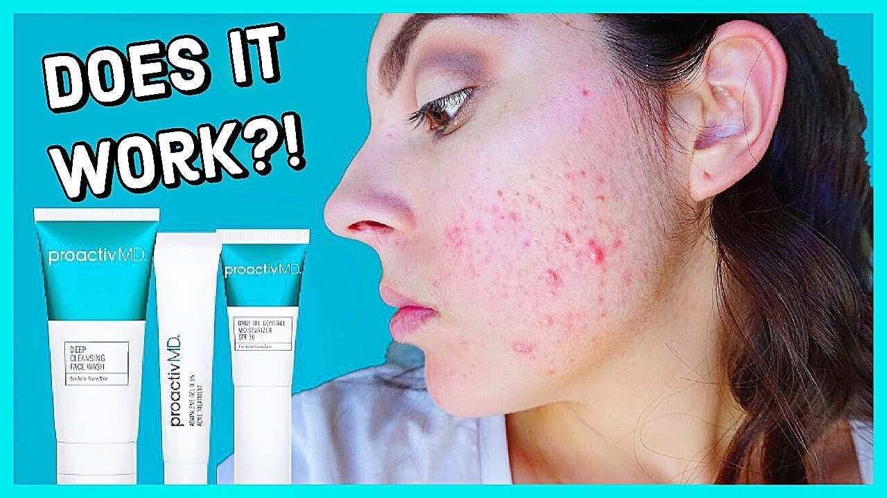 Does Proactiv MD Really Work?! Honest 2 Month Review