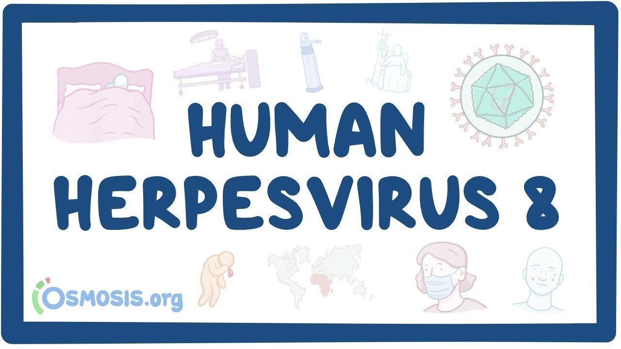 Human herpesvirus 8 (Kaposi's sarcoma) - an Osmosis Preview