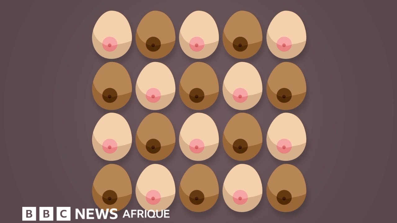 12 sympt&ocirc;mes du cancer du sein