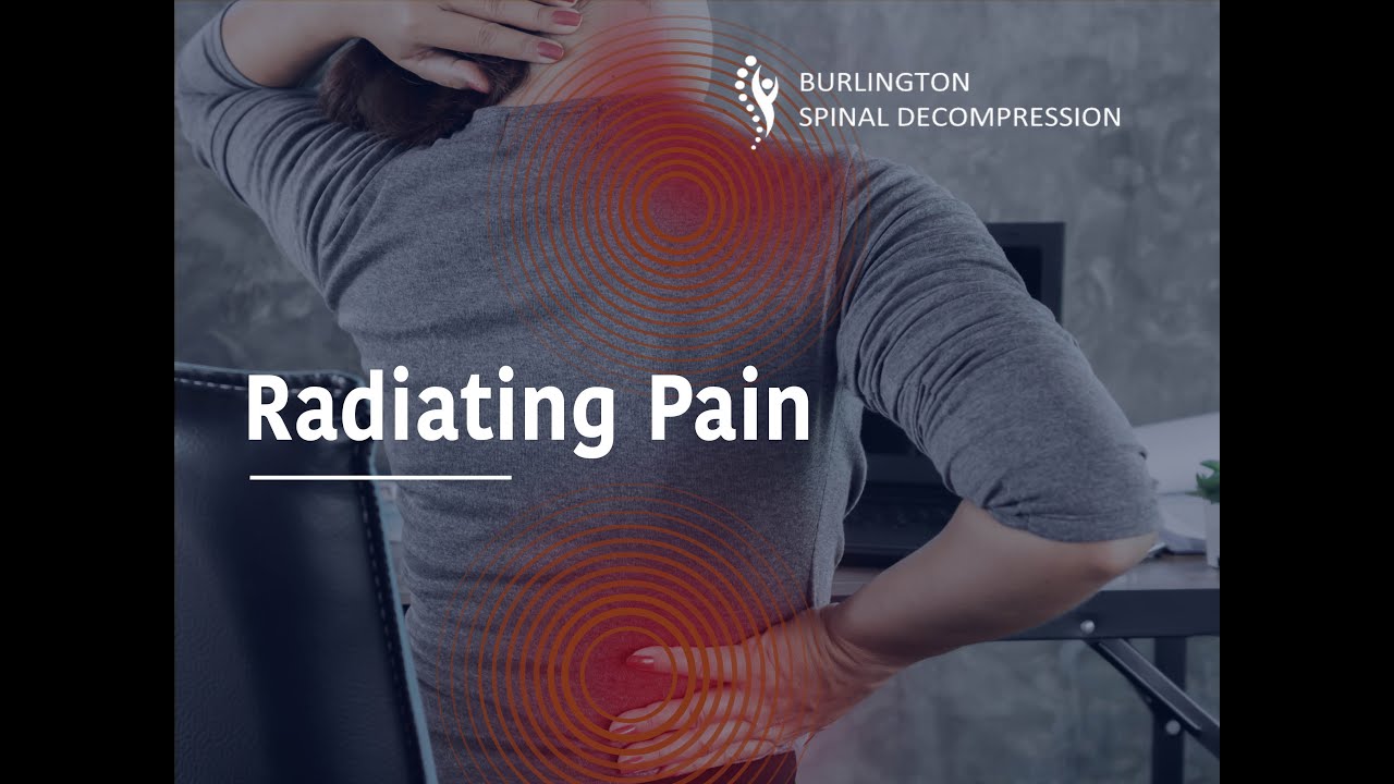 Radiating Pain Explained