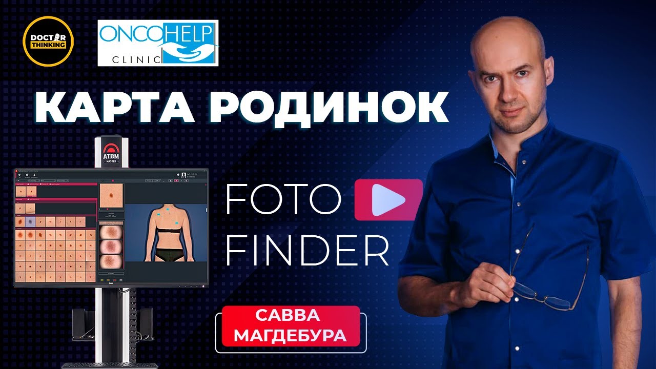 Карта родинок або картування шкіри – Савва Магдебура | COFFEE.MD