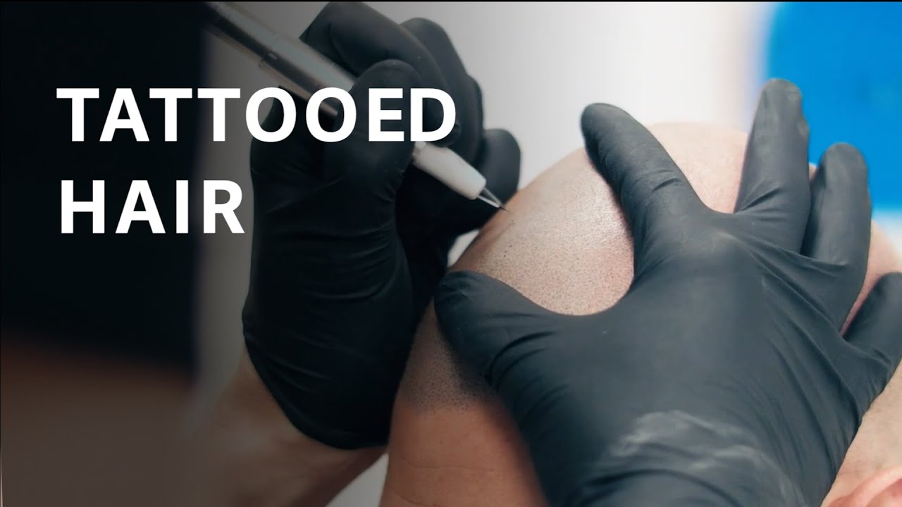 This “hair tattoo” is one cure for baldness