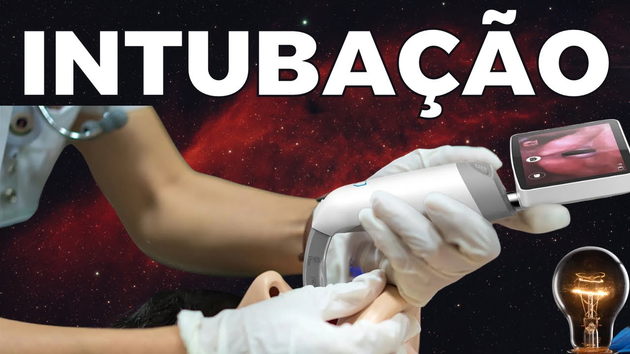 Intubação Orotraqueal - Guia de medicações : Analgesia , Indução e Bloqueio Neuromuscular IOT